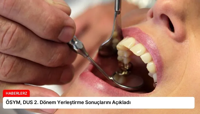 ÖSYM, DUS 2. Dönem Yerleştirme Sonuçlarını Açıkladı